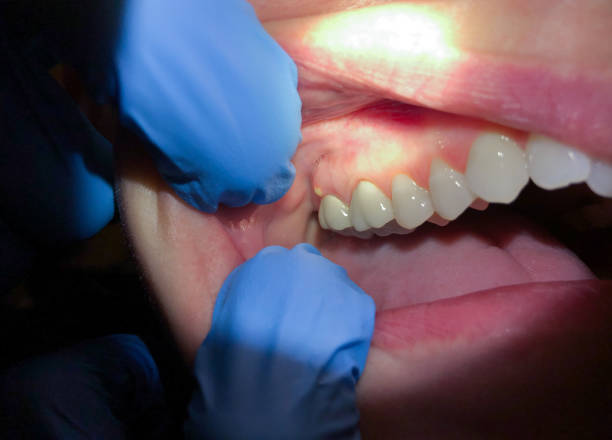 Best Emergency Dentist for Knocked-Out Tooth in USA